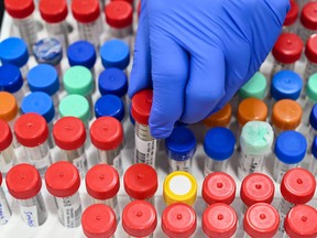 A laboratory staff member places a vial containing a sample collected for COVID-19 coronavirus testing in Mumbai, India.