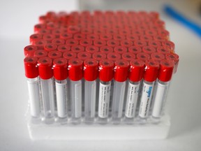 Test tubes for nasal swabs in France.