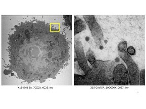 Using electron microscopy, we have visual evidence showing that xylitol and grapefruit seed extract (GSE) counters the virus. The GSE kills the virus, while the xylitol prevents the virus from attaching to the cell walls. The image shows SARS-CoV-2 viruses outside the cell and never attached, thereby preventing infection