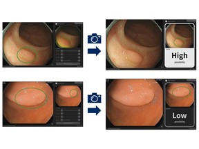 The Cx20 function supports the identification of disease: During examinations, suspected lesions are automatically detected through video taken by endoscope devices. Doctors then extract still images (left) and analysis results are soon displayed (right)