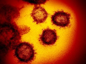 SARS-CoV-2, also known as novel coronavirus, the virus that causes COVID-19.