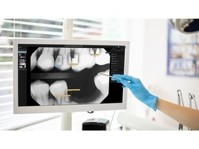 Pearl's Second Opinion® software is the first comprehensive AI-powered real-time pathology detection aid for dentists.