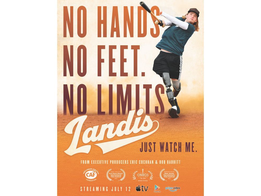 NO HANDS. NO FEET. NO LIMITS. Quad Limb Deficient Teen Showcases the