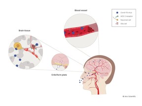 The potential penetration routes of COVID-19 virus to the brain. Once penetrated, the virus can bind and cause damage to neurons and glial cells. Within the blood vessels, the virus can induce thrombus formation causing brain infarcts.