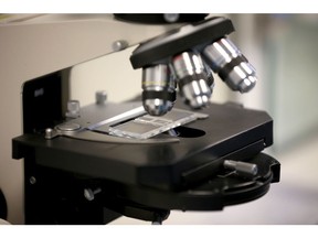 BIRMINGHAM, ENGLAND - JANUARY 22: Sperm samples are monitored under a microscope at Birmingham Women's Hospital fertility clinic on January 22, 2015 in Birmingham, England. Birmingham Womens Hospital provides a range of health services to women and their families using the latest scientific procedures and care. Last year the maternity unit delivered over 8,000 babies, cared for 50,000 patients and performed over 3000 procedures in its state of the art theatres. The hospital is also home to world renowned research scientists, fertility clinic and the national sperm bank.