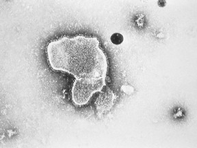 FILE - This 1981 photo provided by the Centers for Disease Control and Prevention (CDC) shows an electron micrograph of Respiratory Syncytial Virus, also known as RSV. New research announced by Pfizer on Tuesday, Nov. 1, 2022, showed vaccinating pregnant women helped protect their newborns from the common but scary respiratory virus that fills hospitals with wheezing babies each fall. (CDC via AP, File)