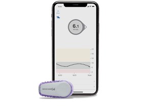 NIHB clients of all ages with type 1 diabetes are now eligible for coverage of the Dexcom G6 CGM System.