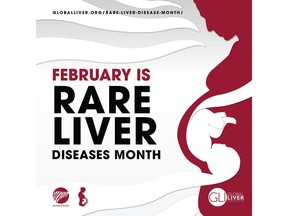 Join the conversation by using #RareAware.

Learn more: https://globalliver.org/rare-liver-diseases-month/