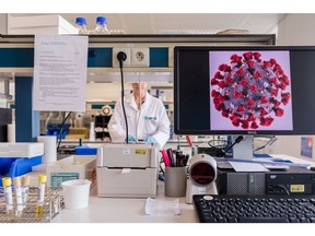 A magnified coronavirus germ is displayed on a desktop computer monitor during coronavirus patient sample detection tests in the virology research labs at UZ Leuven university hospital in Leuven, Belgium, on Friday, Feb. 28, 2020. China has kick-started a clinical trial to speedily test a drug for the novel coronavirus infection as the nation rushes therapies for those afflicted and scours for vaccines to protect the rest. Photographer: Geert Vanden Wijngaert/Bloomberg