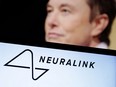 The Neuralink logo and Elon Musk are seen in this illustration.