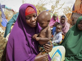 FILE - Nunay Mohamed, 25, who fled the drought-stricken Lower Shabelle area, holds her one-year old malnourished child at a makeshift camp for the displaced on the outskirts of Mogadishu, Somalia on June 30, 2022. More than a quarter-billion people in 58 countries faced acute food insecurity last year because of conflicts, climate change, the effects of the COVID-19 pandemic and Russia's war in Ukraine, according to a report published Wednesday, May 3, 2023.
