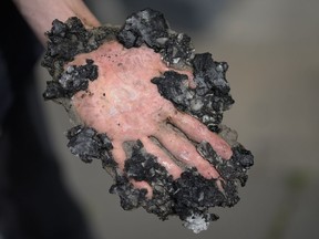 A climate activist shows his hand, covered with asphalt, after policers remove is hand with hammer and chisel from a road in Berlin, Germany, Monday, May 22, 2023.