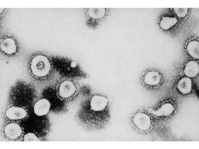 A microscopic view of the SARS-CoV-2 virus particles. Photographer: CDC/Getty Images