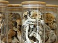 A jar of magic mushrooms and psilocybin is seen in this file image.