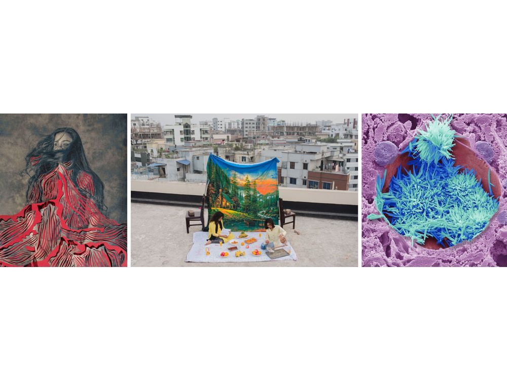 Wellcome Photography Prize 2025: Winning Images Reveal Powerful Stories of Science and Health