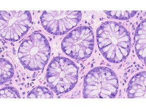 Intestine