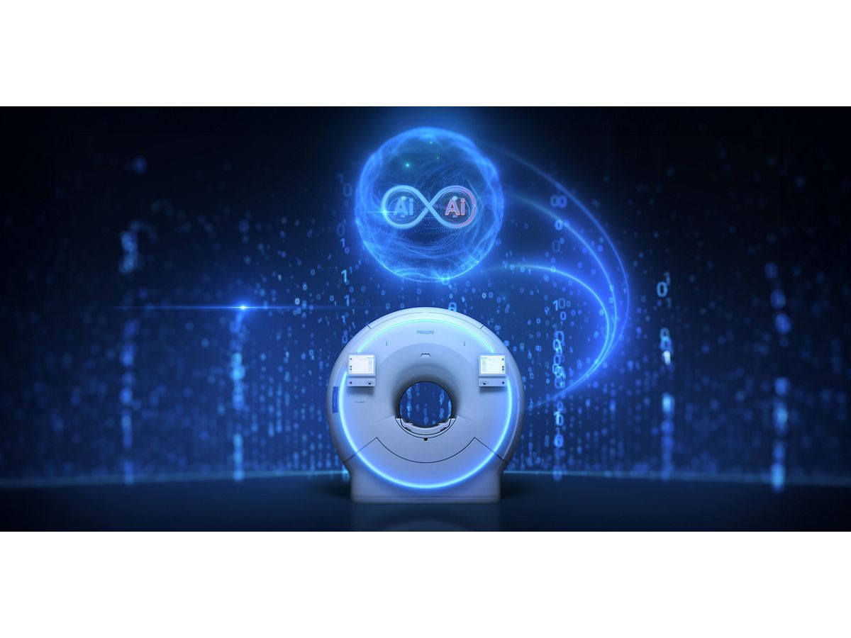 Dual AI engines in SmartSpeed Precise