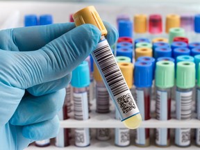 Health Canada, which oversees health policy, cited “recurring, systemic deficiencies across several sites” as the reason for placing terms and conditions on Grifols’ blood establishment licence.