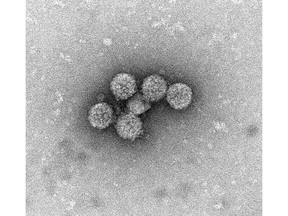 Orthogon Therapeutics Raises Additional M in Funding for its BK Virus Antiviral Drug Program Orthogon Therapeutics Raises Additional M in Funding for its BK Virus Antiviral Drug Program