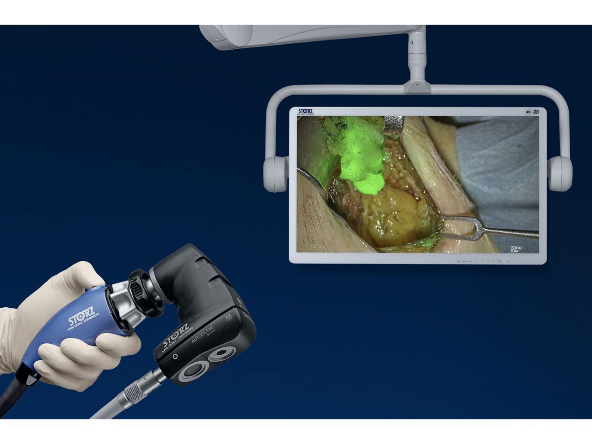 The Rubina™ Lens digital exoscope displays a magnified 4K image of the surgical field on a monitor. The ability to switch to NIR/ICG fluorescence imaging helps reveal information that cannot be seen with the naked eye.