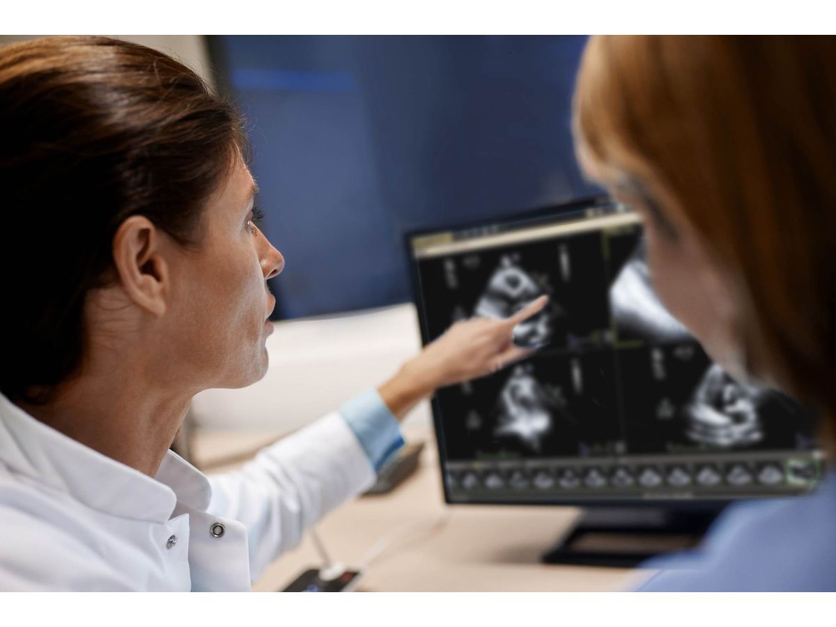 Philips cardiology informatics at TCT
