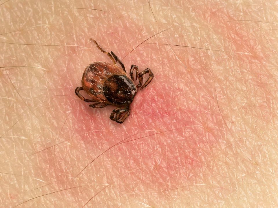 tick on skin with rash
