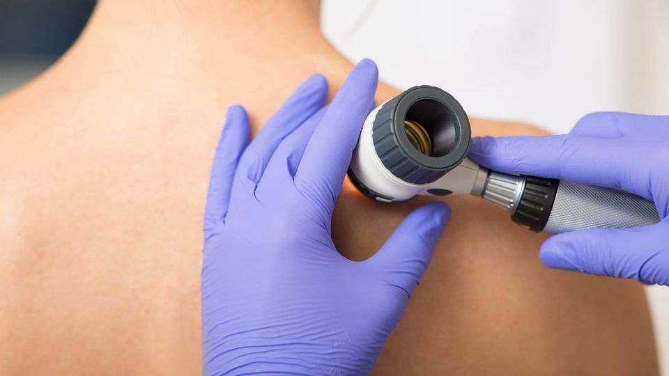 dermatologist Inspecting patient skin moles at clinic