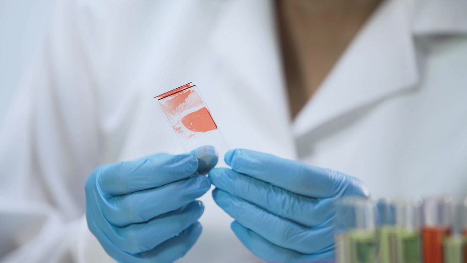 Medical worker analyzing microbiological specimens, blood sample