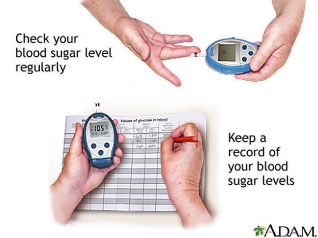 Checking your blood sugar levels often and recording the results will tell you how well you are managing your diabetes so you can stay as healthy as possible. The best times to check your blood sugar are before meals and at bedtime. Your blood sugar meter may have software to help you track your blood sugar level. This is usually available from the manufacturer's website.