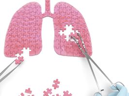 Lungs operation