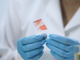 Medical worker analyzing microbiological specimens, blood sample