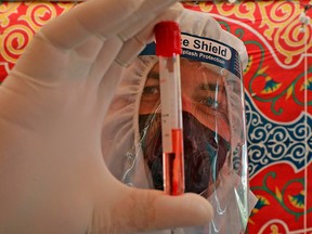 A doctor displays a blood sample taken from a person suspected of being infected with COVID-19 in Hebron, in the occupied West Bank, on July 15, 2020.