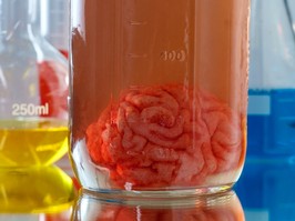 brain sample in a jar