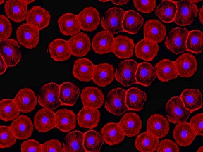 A different combination of chemotherapy drugs together with umbilical cord blood may result in a safer, more universal treatment for a variety of genetic disorders.