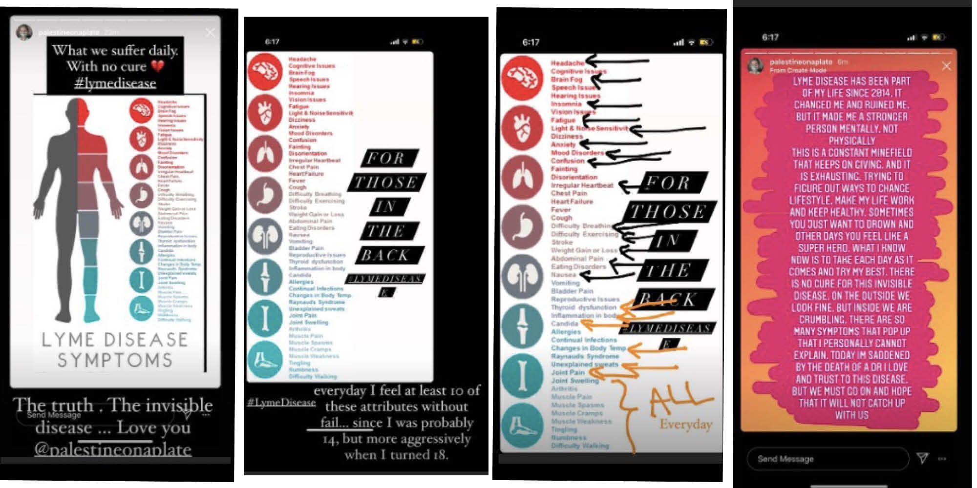  model bella hadid shared her experience with lyme disease on instagram.