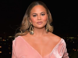 Chrissy Teigen botox