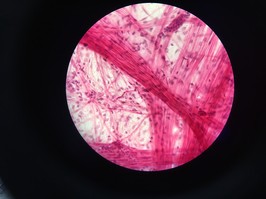 Heart tissue under microscope