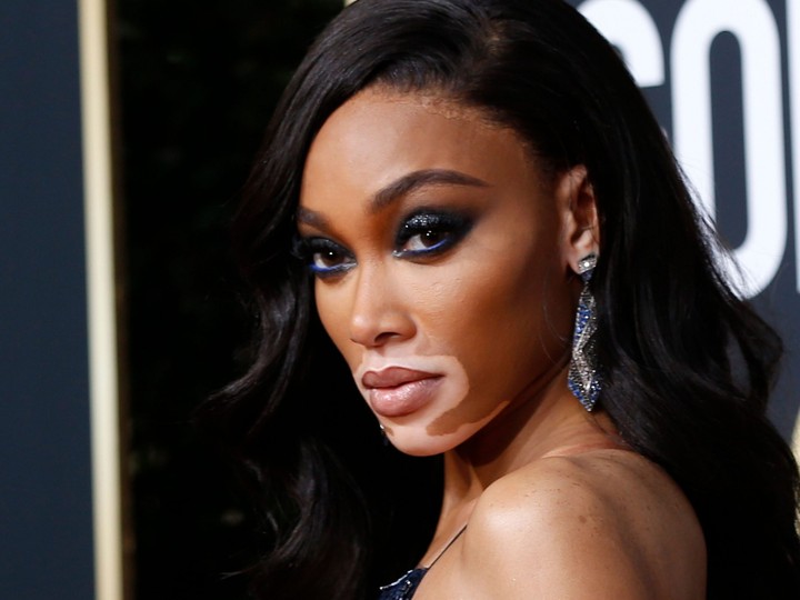 Winnie Harlow at the 77th Golden Globe Awards in California, January 5, 2020.