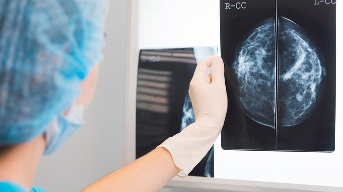 New breast cancer treatment only takes minutes