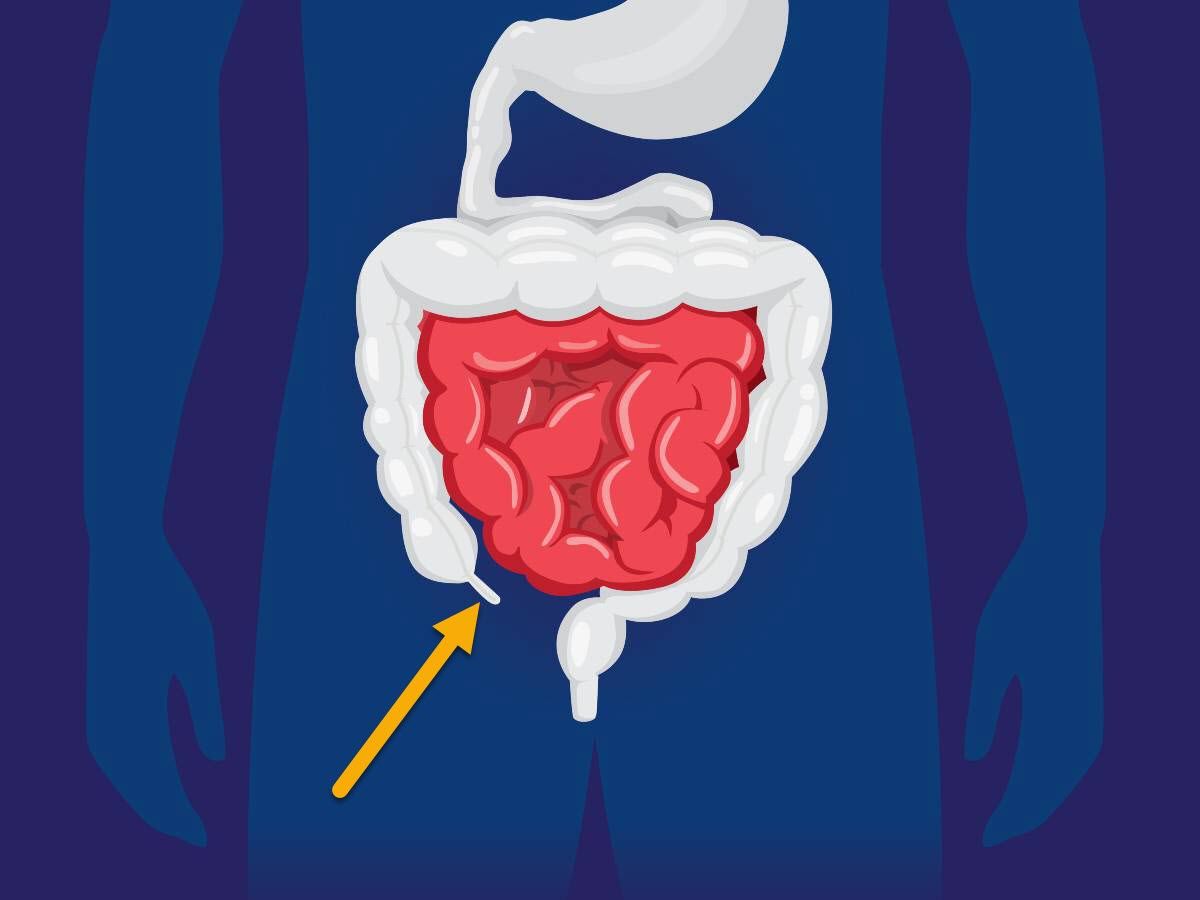 a look at the appendix, its location and purpose and symptoms of appendicitis.