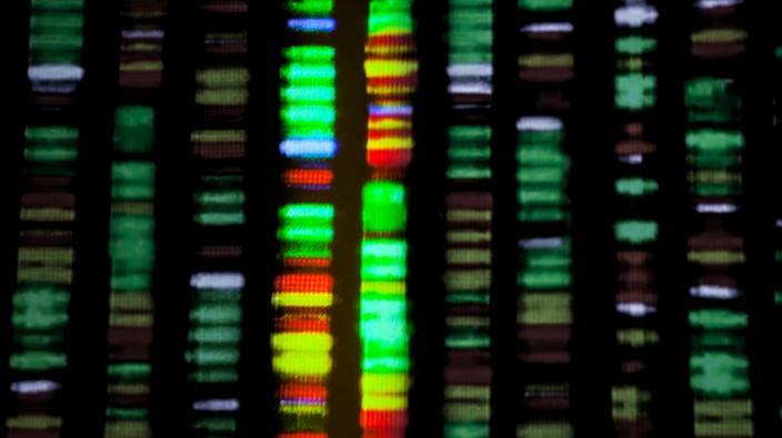 Study uncovers genes linked to kidney disease