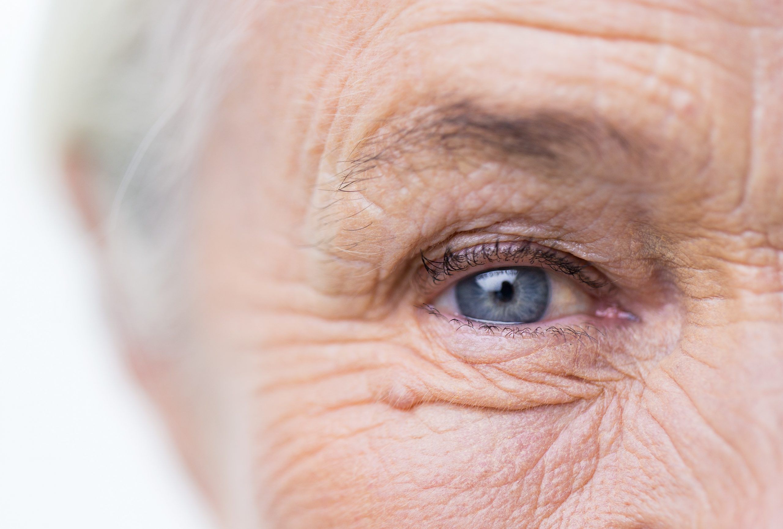 It was estimated that in 2019 more than 2.5 million Canadians were living with AMD, the leading cause of vision loss in people over the age of 50. ISTOCK. 
