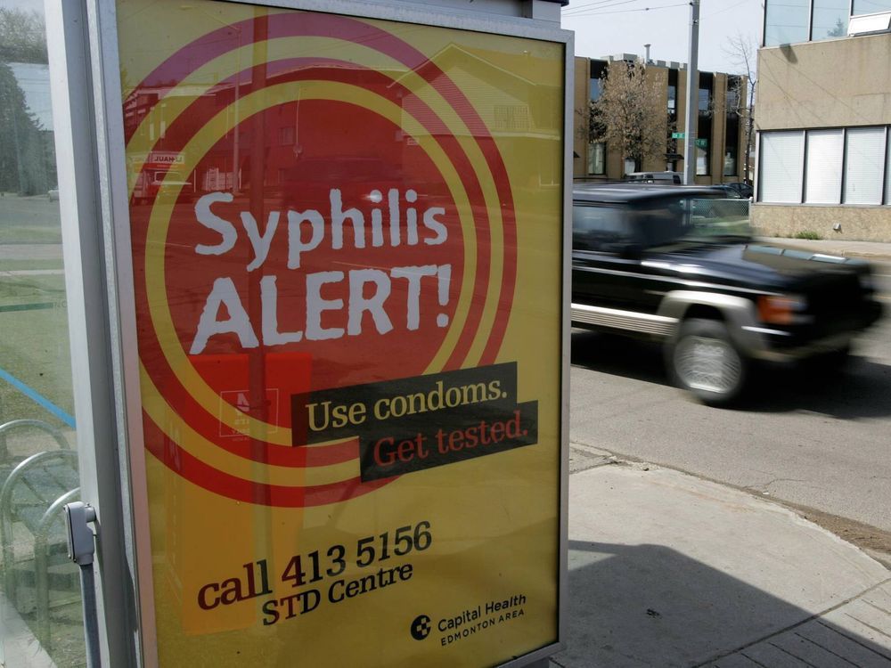 Number of syphilis cases in Alberta spike