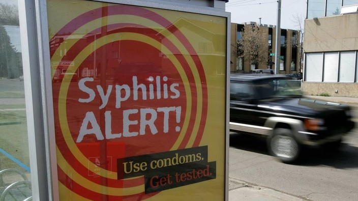 Number of syphilis cases in Alberta spike