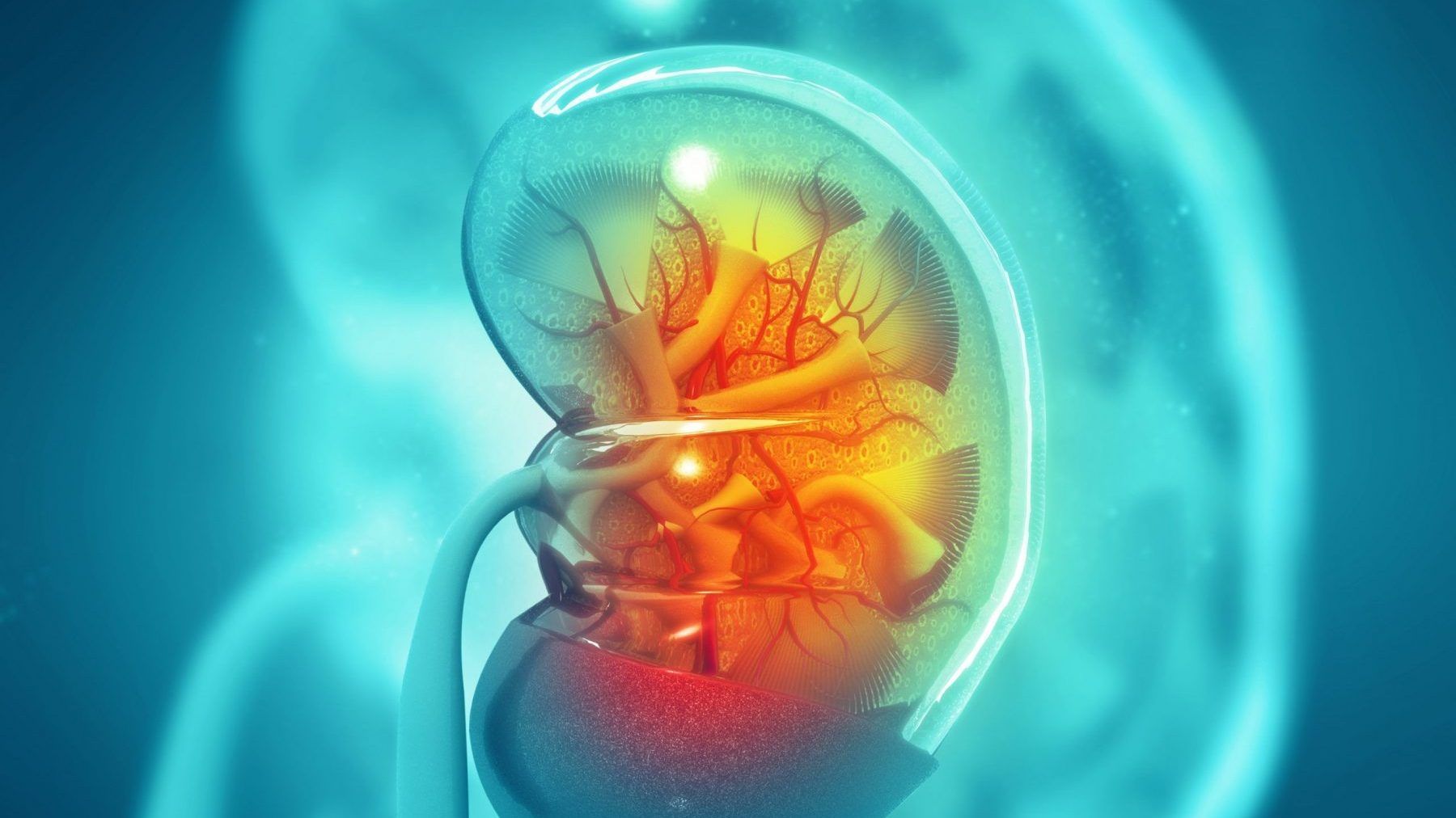 IgA Nephropathy (IgAN) is a condition where buildup of the protein Immunoglobulin A (IgA) causes inflammation and damage to the kidneys. GETTY