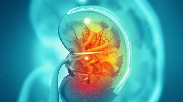 IgA Nephropathy can progress to kidney failure
