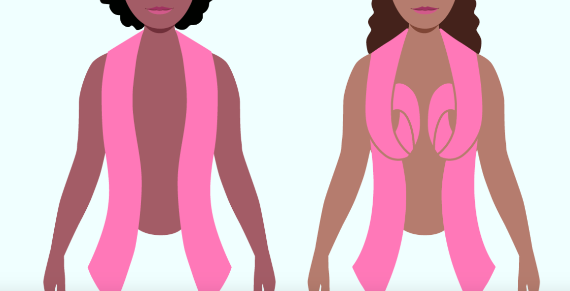 Going flat: Breast cancer survivors advocate for 'normal, beautiful' aesthetic  flat closure