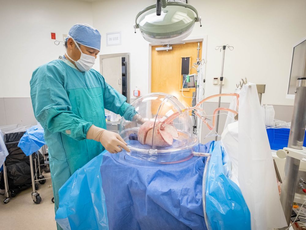 a file photo of dr. john yee, the director of the lung transplant program at vancouver general hospital. since april 2021, yee has performed nine double lung transplants on people who suffered severe lung damage from covid-19.