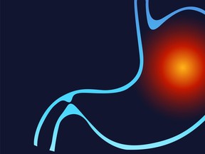 Stomach heartburn. Stomach pain, gastritis, indigestion, vomiting, heartburn problems. Heartburn and Gastritis isolated. The concept with indigestion and stomach pain problems. Vector flat