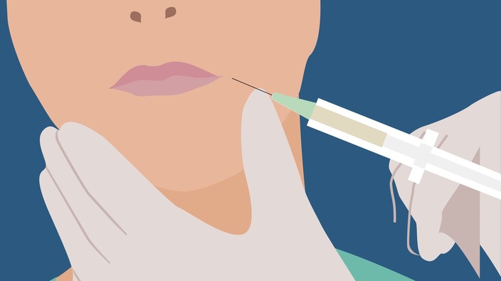 Getting rid of 'angry face': What you should know about botox and dermal fillers